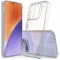 Coque arrière Phonesta Scratchproof pour Xiaomi 15 - Transparent